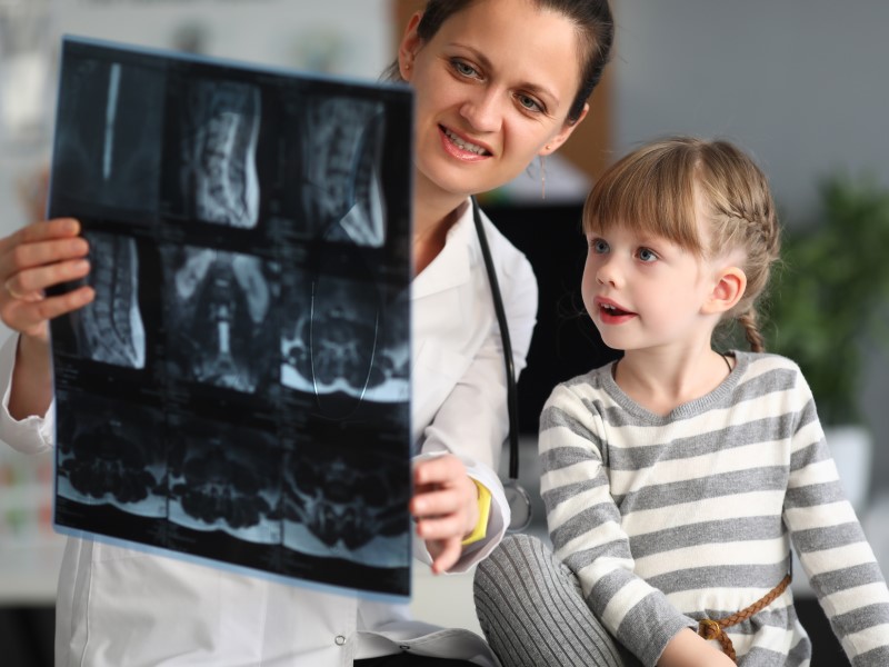 Рентгенография (рентген, РТГ) для детей в VCA