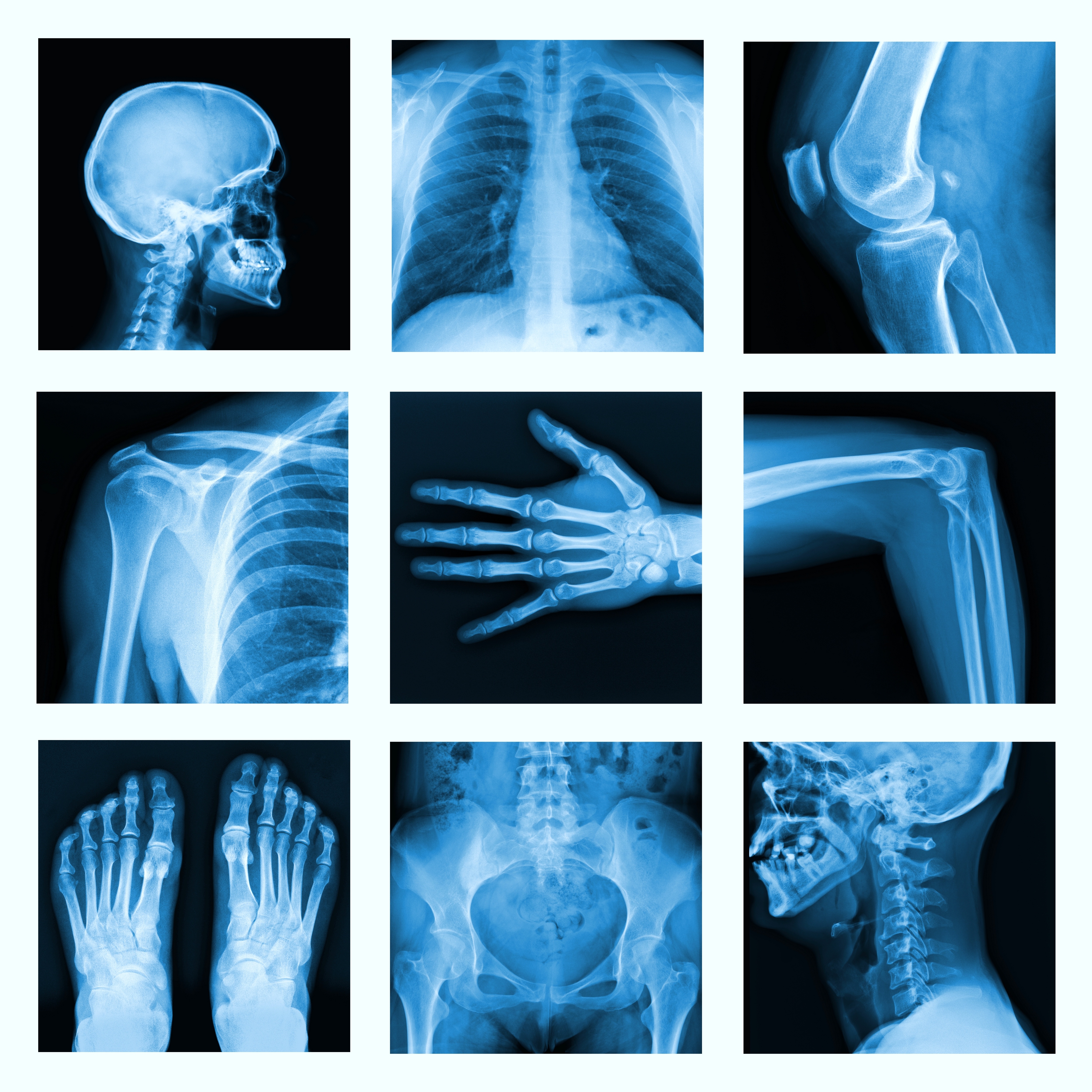 Digitālā rentgena izmeklējumi VCA poliklīnikā Vesels