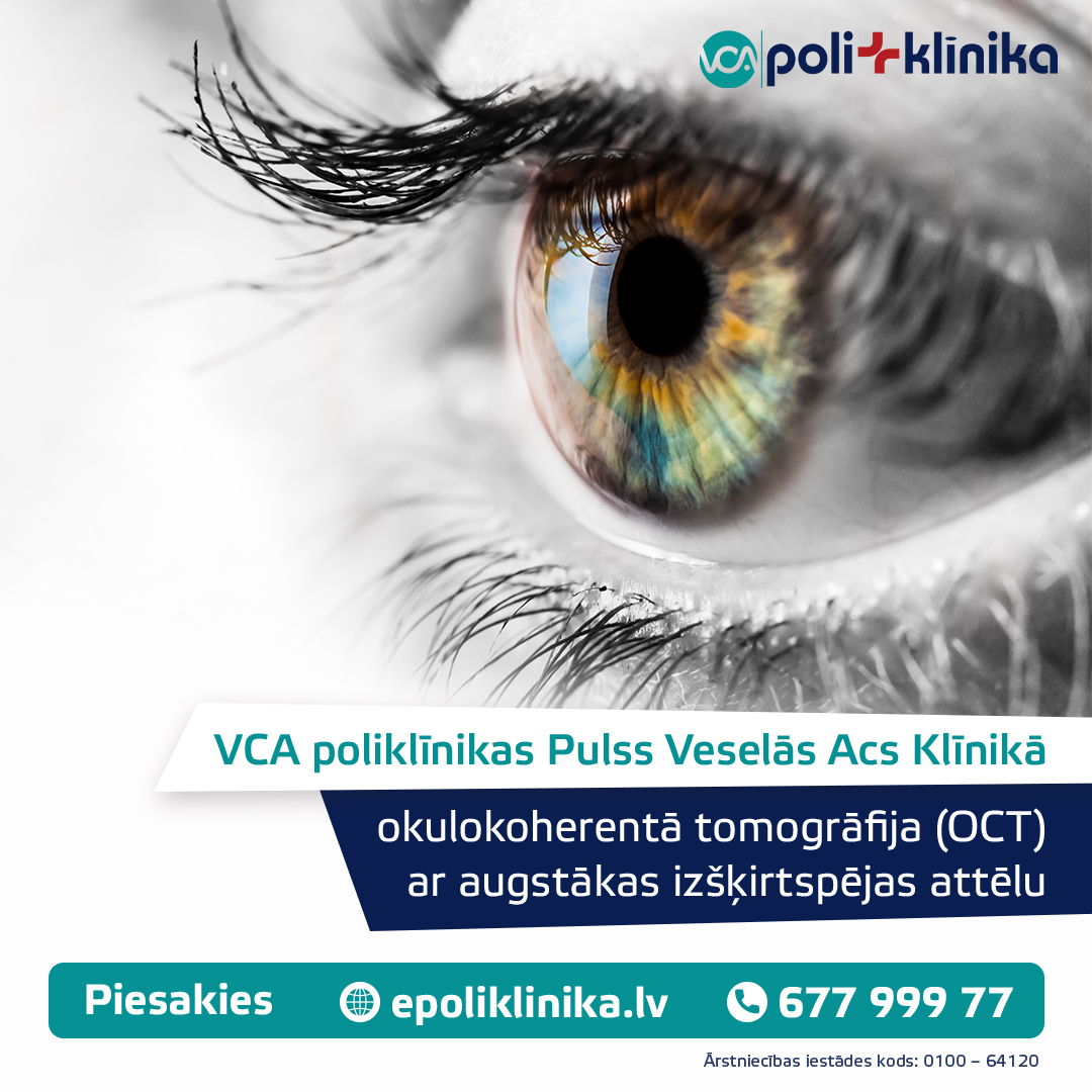 VCA poliklīnika - Okulokoherentā tomogrāfija (OCT)