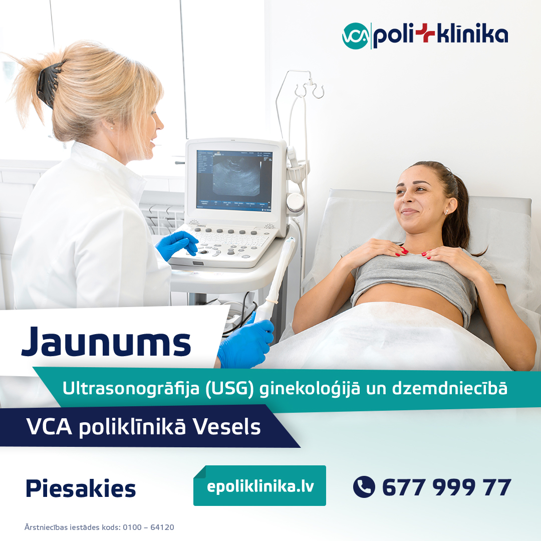 Jaunums: USG VCA poliklīnika Vesels