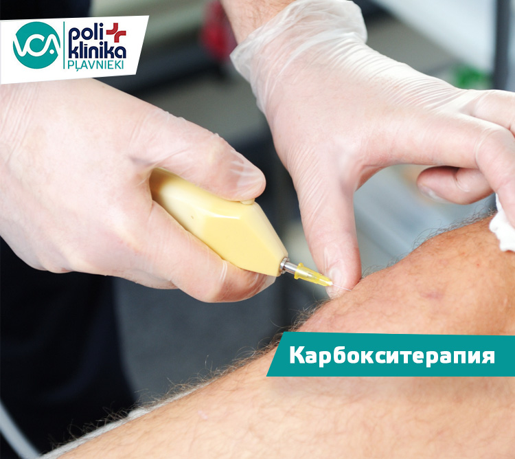 Карбокситерапия