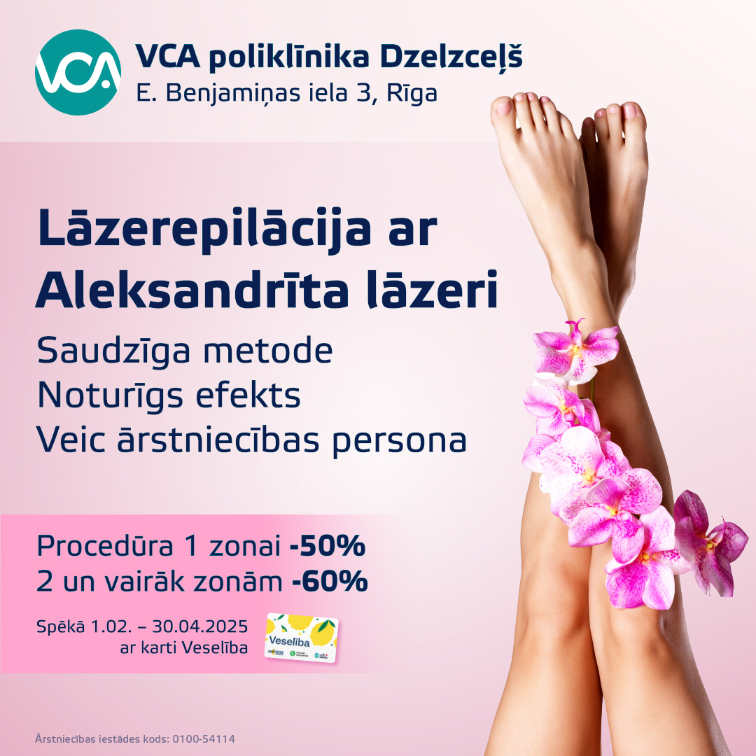 Atlaides lāzerepilācijai