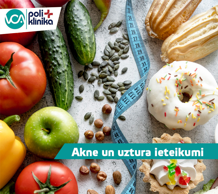 Akne un uztura ieteikumi