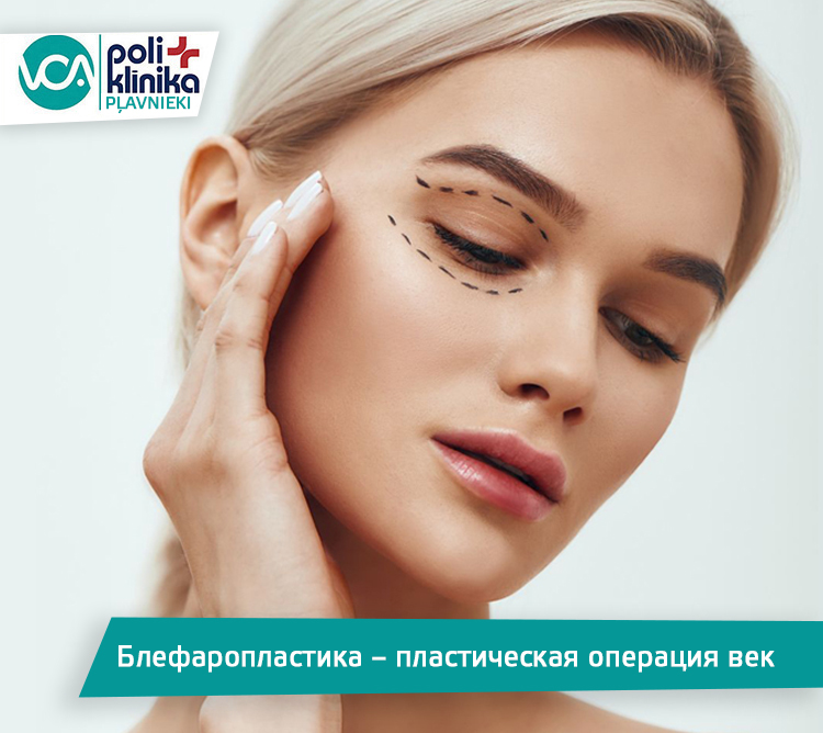 Блефаропластика – пластическая операция век