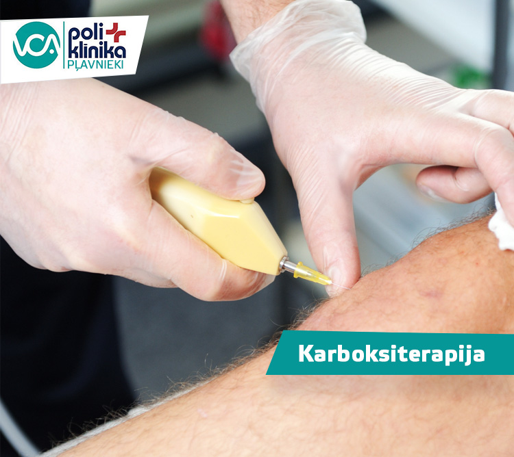 Karboksiterapija 