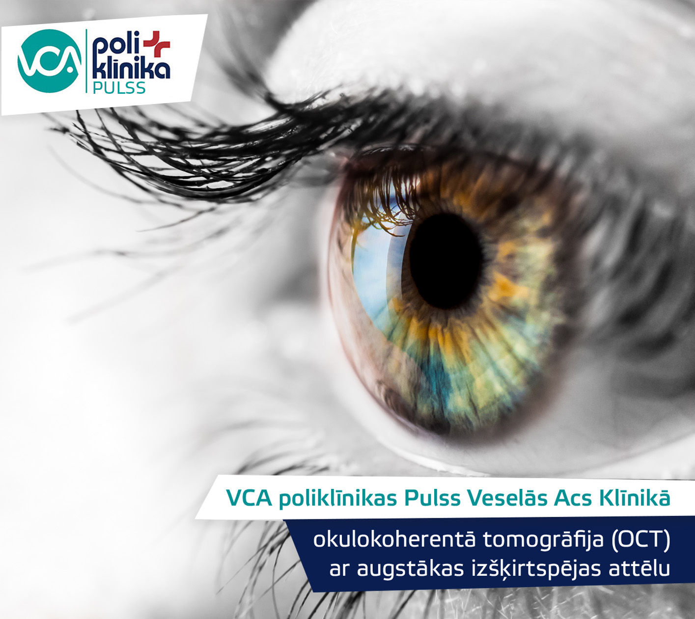 OCT ar liela palielinājuma moduli Veselās Acs Klīnikā VCA poliklīnikā Pulss
