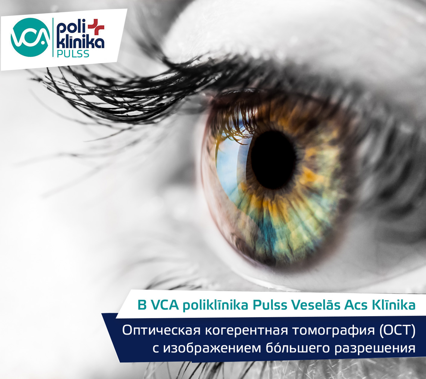 OCT с модулем большого увеличения в клинике Veselās Acs Klīnikа VCA poliklīnika Pulss