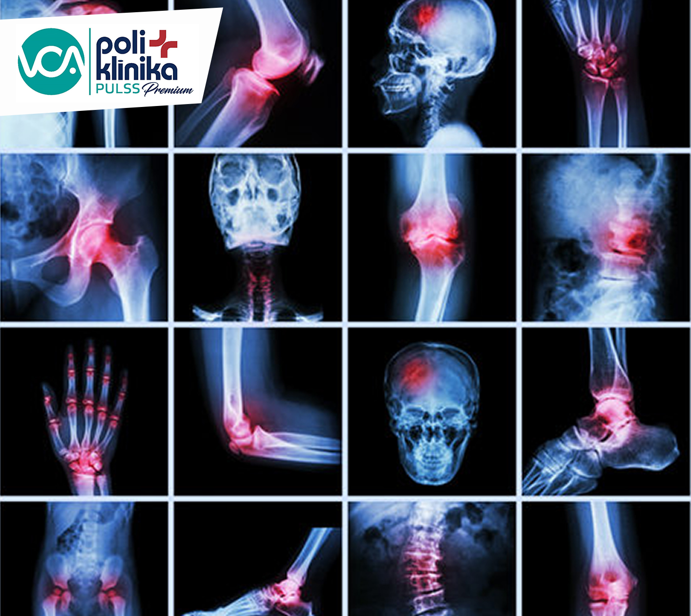 VCA Pulss Premium nodaļā atsāk darbu reimotologs Dr. Kristina Toločko.