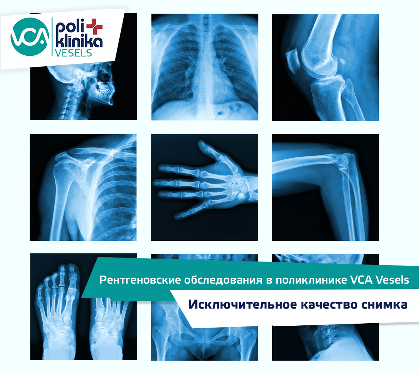 Дигитальной pентгеновские исследования в VCA poliklīnika Vesels