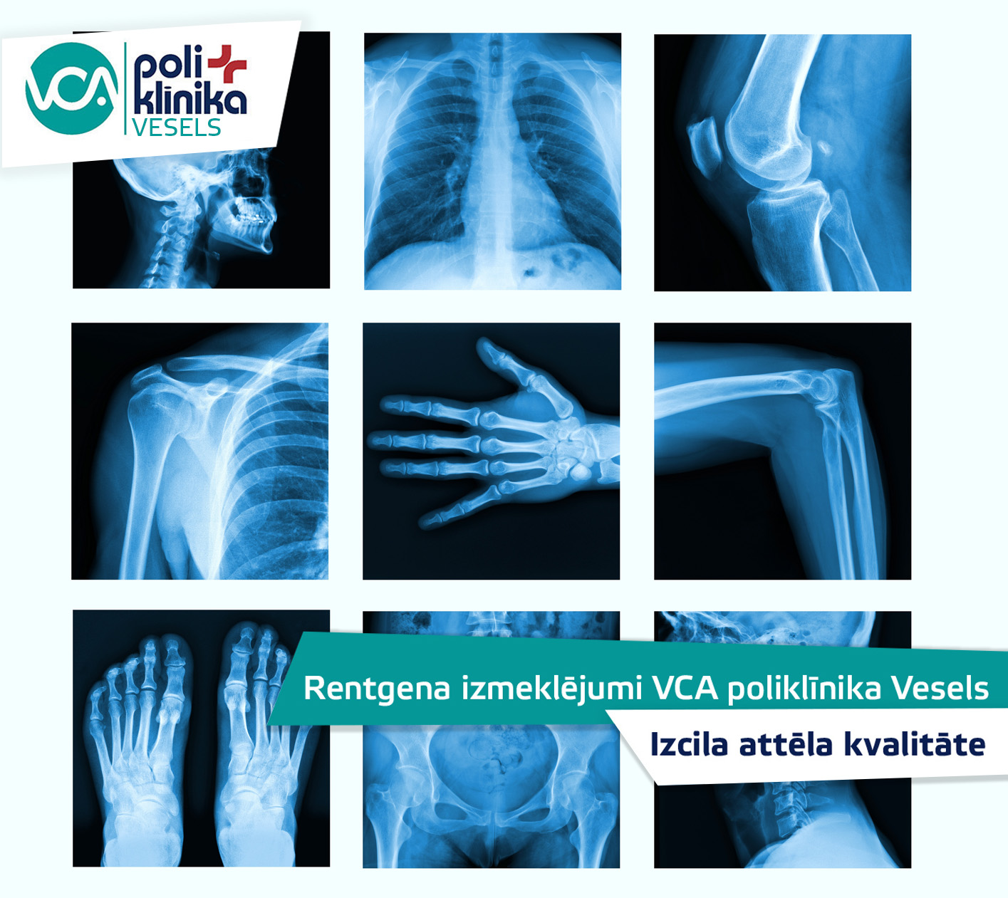 Digitālā rentgena izmeklējumi VCA poliklīnikā Vesels