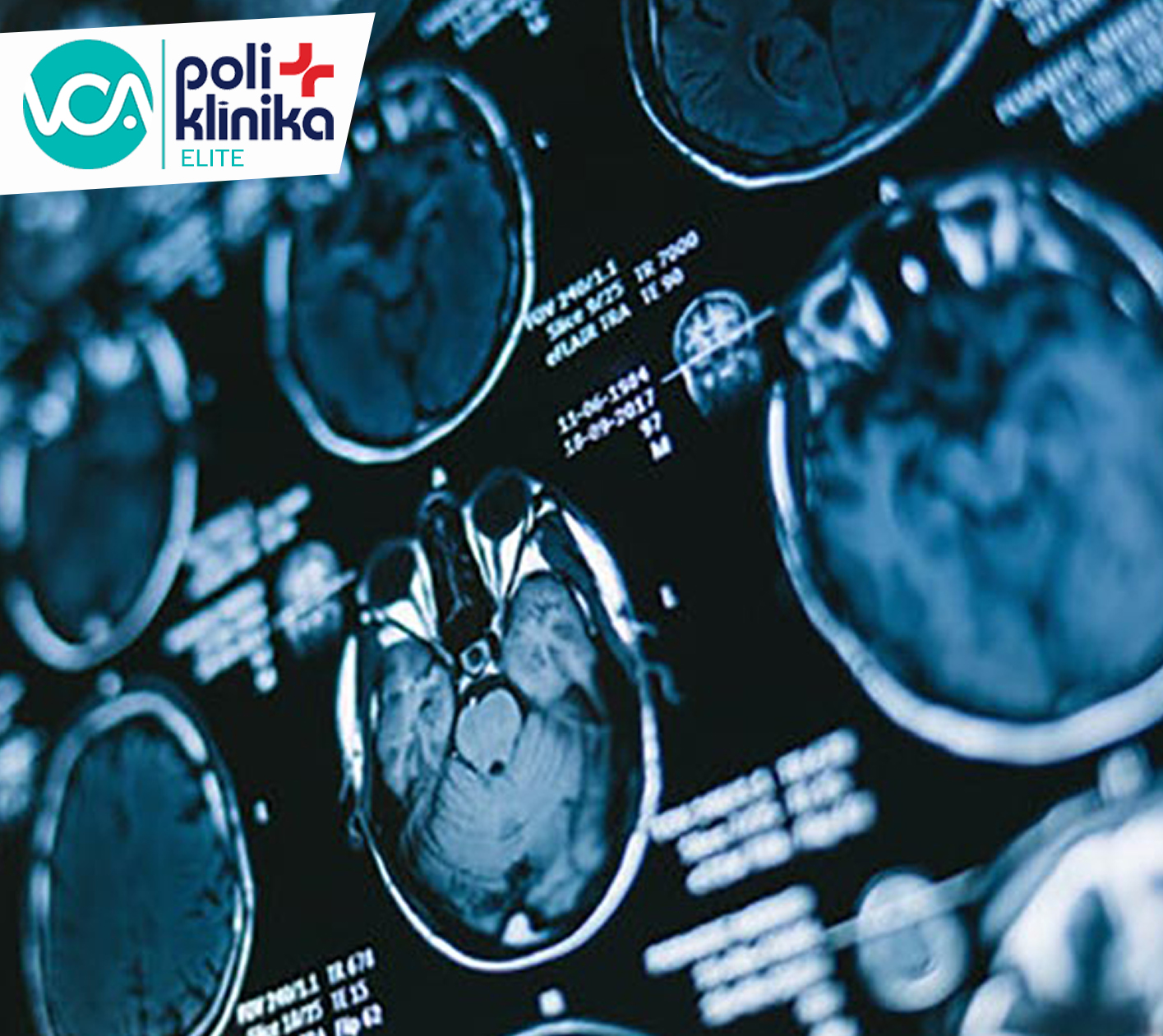 Magnētiskā rezonanse VCA poliklīnikā &quot;Elite&quot;