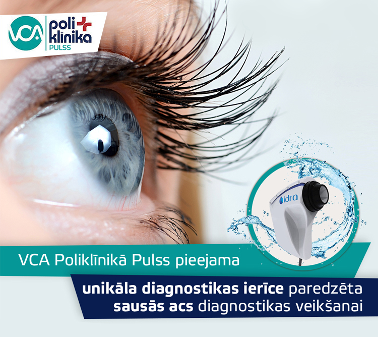 Jaunas diagnostikas iespējas – sausās acs sindromam!