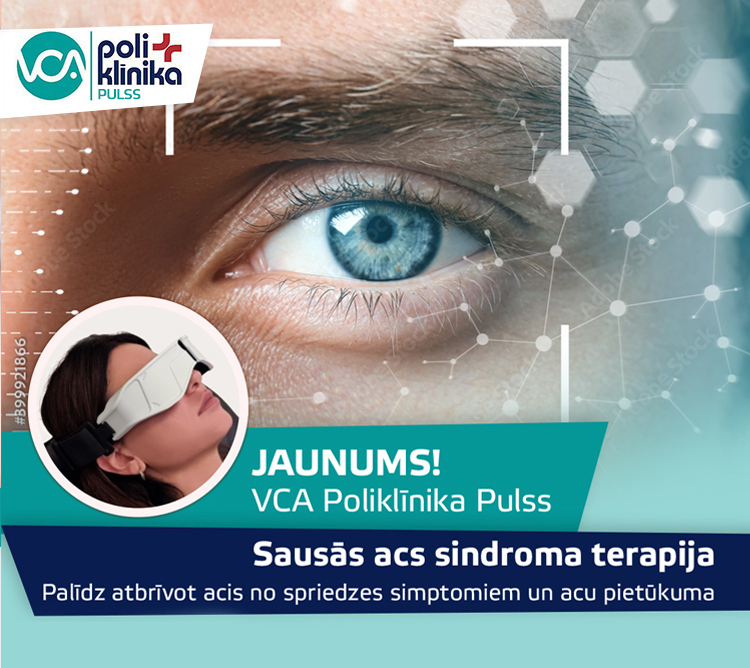 Sausās acs terapija ar SBM Sistemi ACTIVA – uzlabo savu acu labsajūtu!