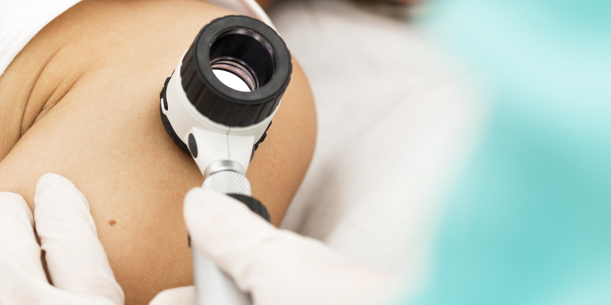 VCA “Mežaparka doktorātā” sāk pieņemšanas dermatologs/ venerologs Dr. Irēna Gavriša.