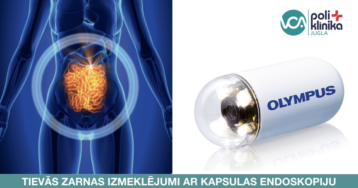 Kapsulas endoskopija VCA poliklīnikā ''Jugla''