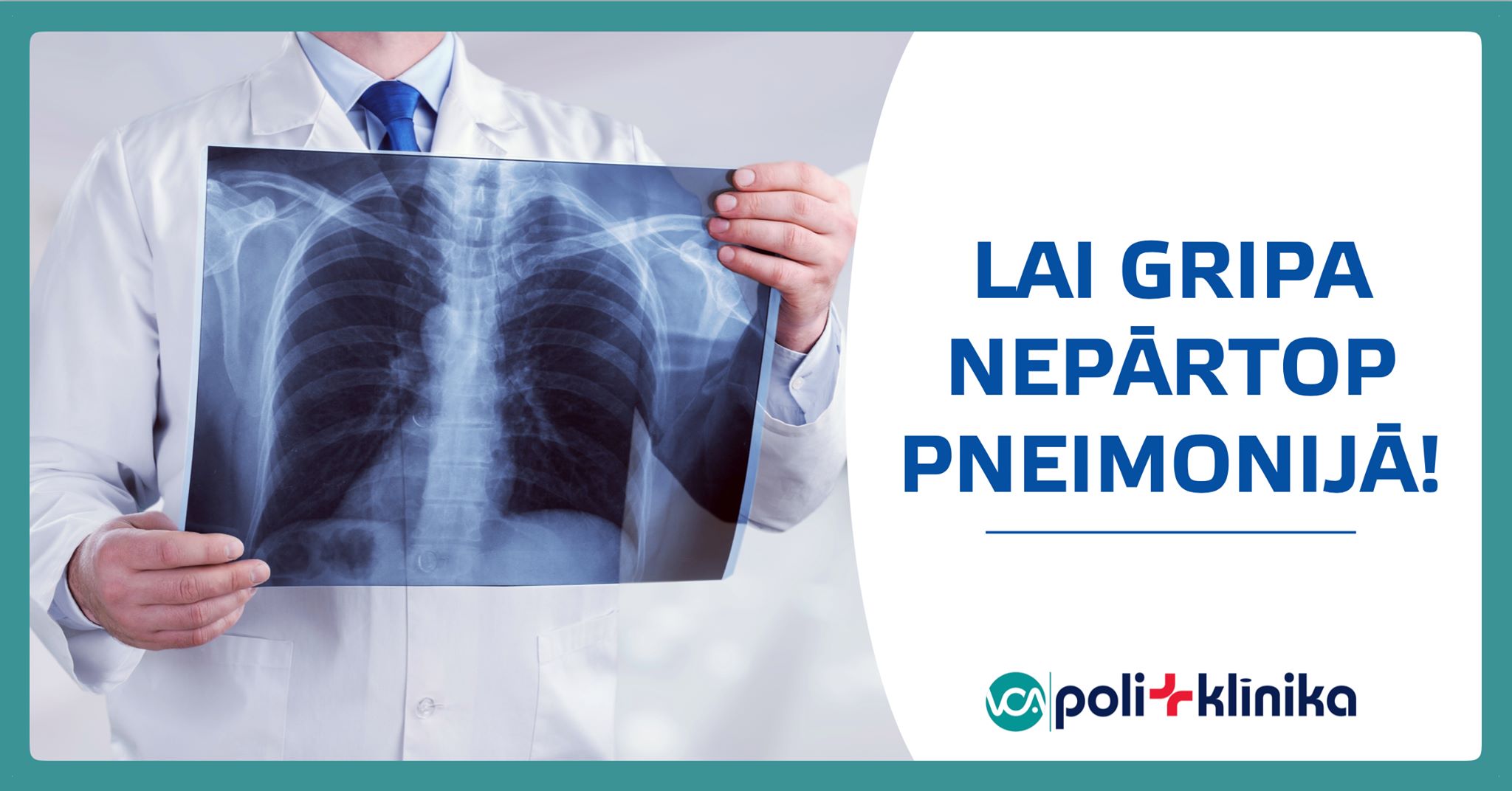 Lai gripa nepārtop pneimonijā.