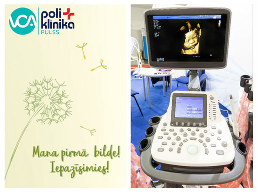 3D/4D ultrasonogrāfija VCA poliklīnikā ''Pulss 5''