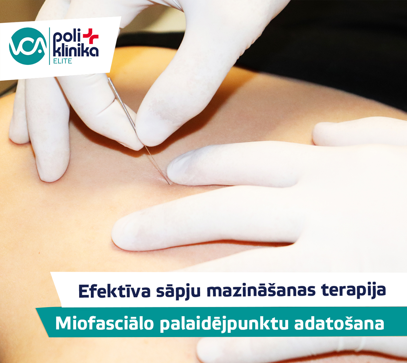 Sāpju mazināšanas terapija