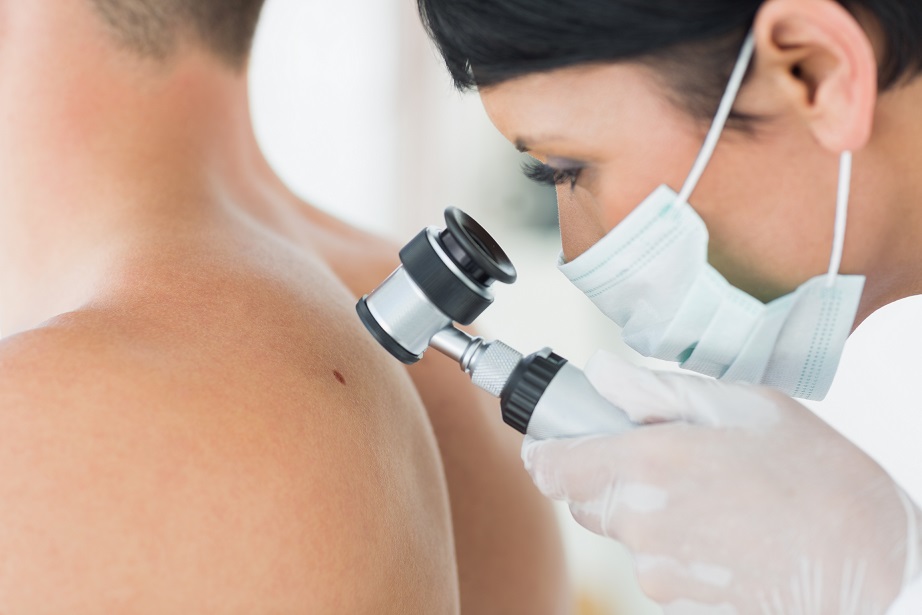 Ne – melanomas diena! VCA Poliklīnikā Aura
